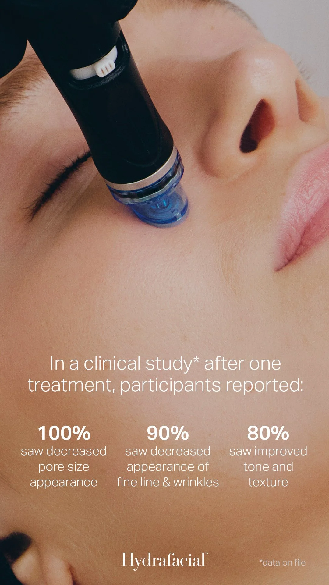 Close-up of a person receiving a HydraFacial treatment, with text overlay reporting study results: 100% saw decreased pore size, 90% saw decreased fine lines and wrinkles, and 80% saw improved skin tone and texture.