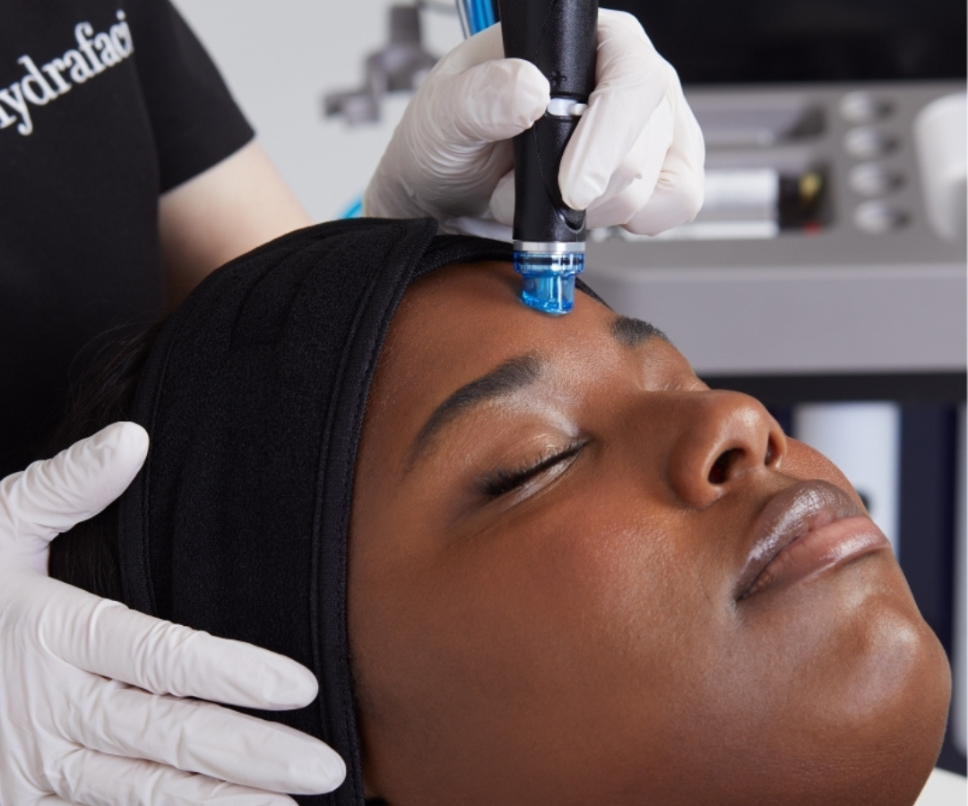 HydraFacial Vs Other Facials