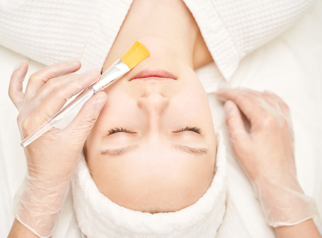 Why Chemical Skin Peels Are Totally Worth It