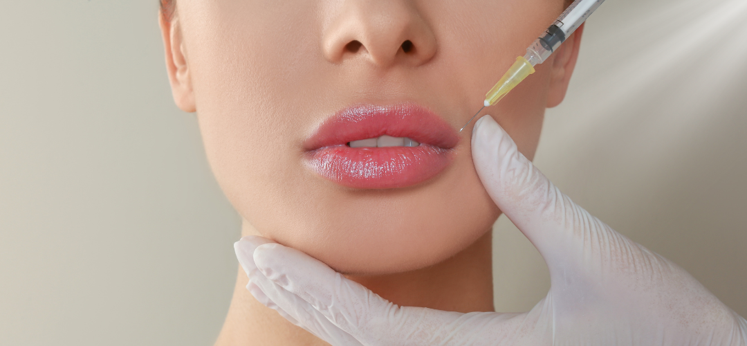 The Importance of Choosing the Right Practitioner for your Lip Fillers