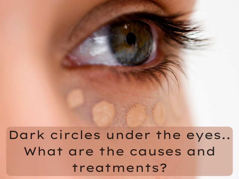 Dark circles under the eyes – what are the causes and treatments?
