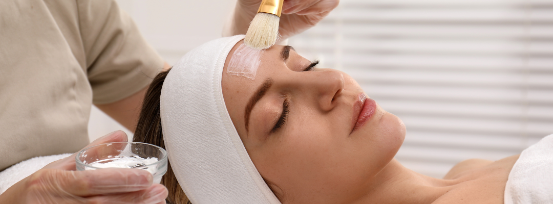 The Benefits of Chemical Peels for Acne-Prone and scarred Skin