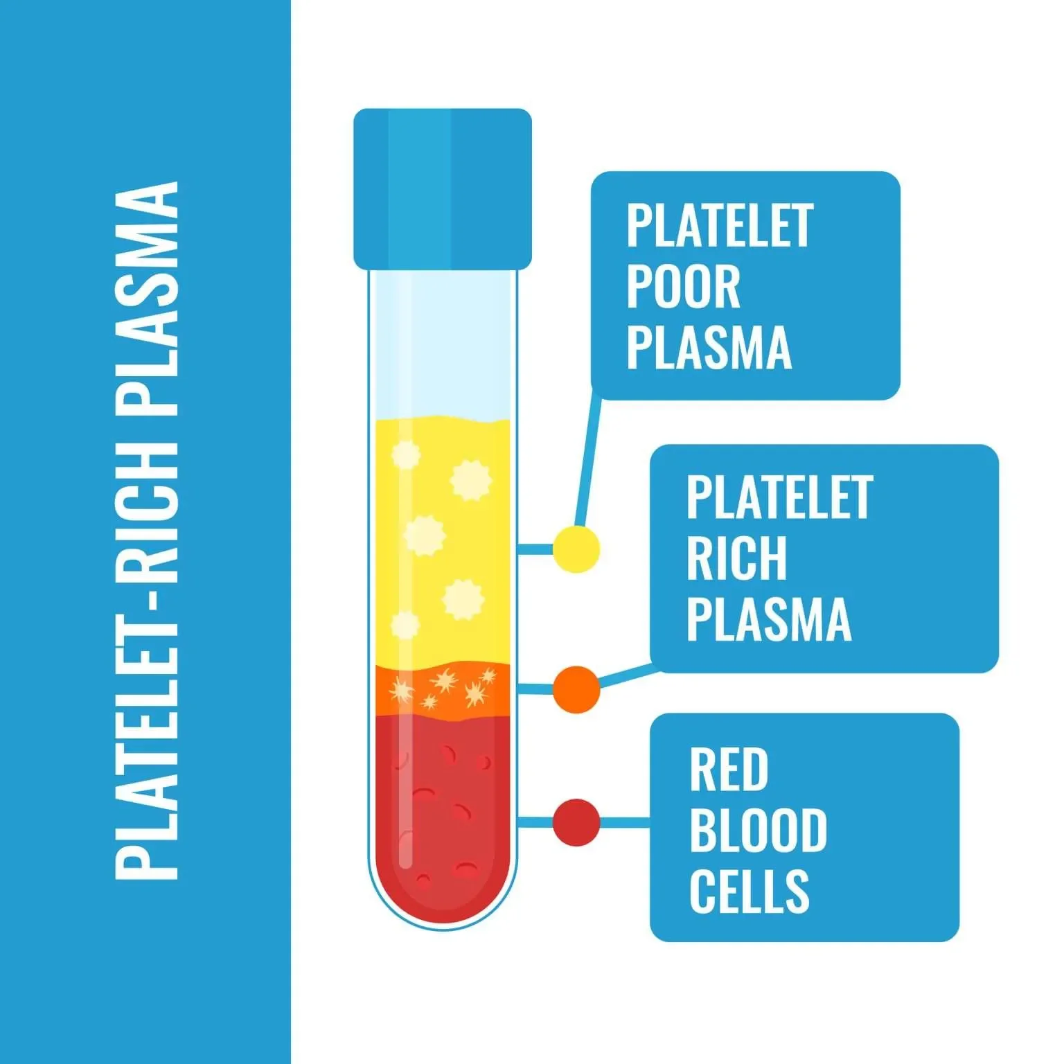 Diagram of blood plasma components showing three layers: red blood cells at the bottom, a thin layer of rich plasma, and a top layer of poor plasma, with labels indicating each part.