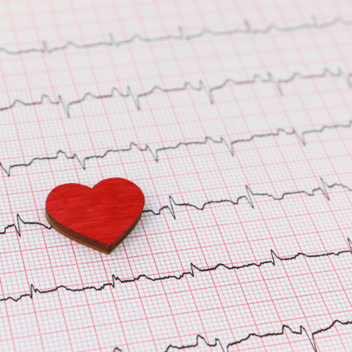An electrocardiogram (ECG) reading on red graph paper with a red wooden heart placed on top.