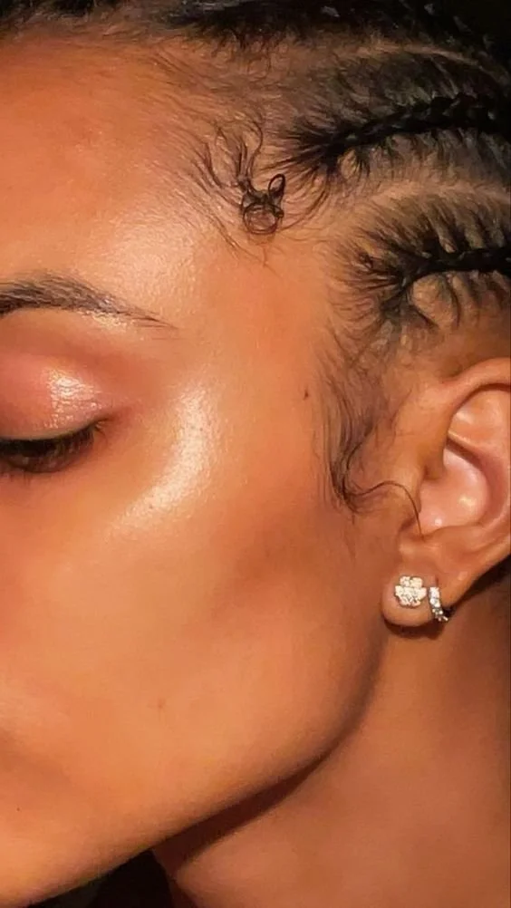 Battling Cystic Acne Caused by Dairy: A Personal Journey