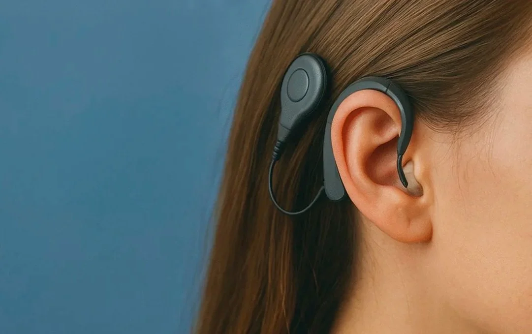 Bone Anchored Hearing Aids Cochlea Implants