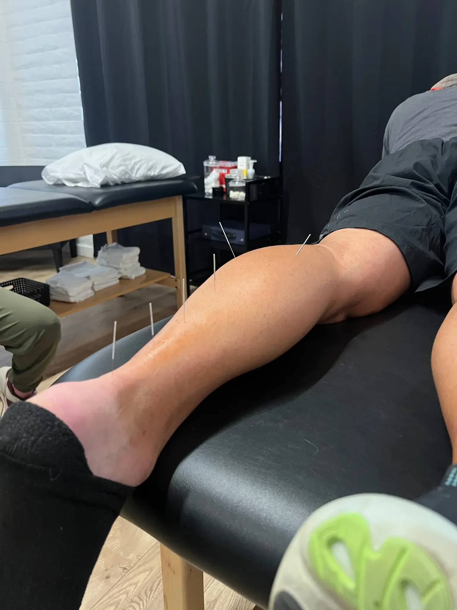 dry needling physical therapist in Scottsdale for weightlifting injury recovery.