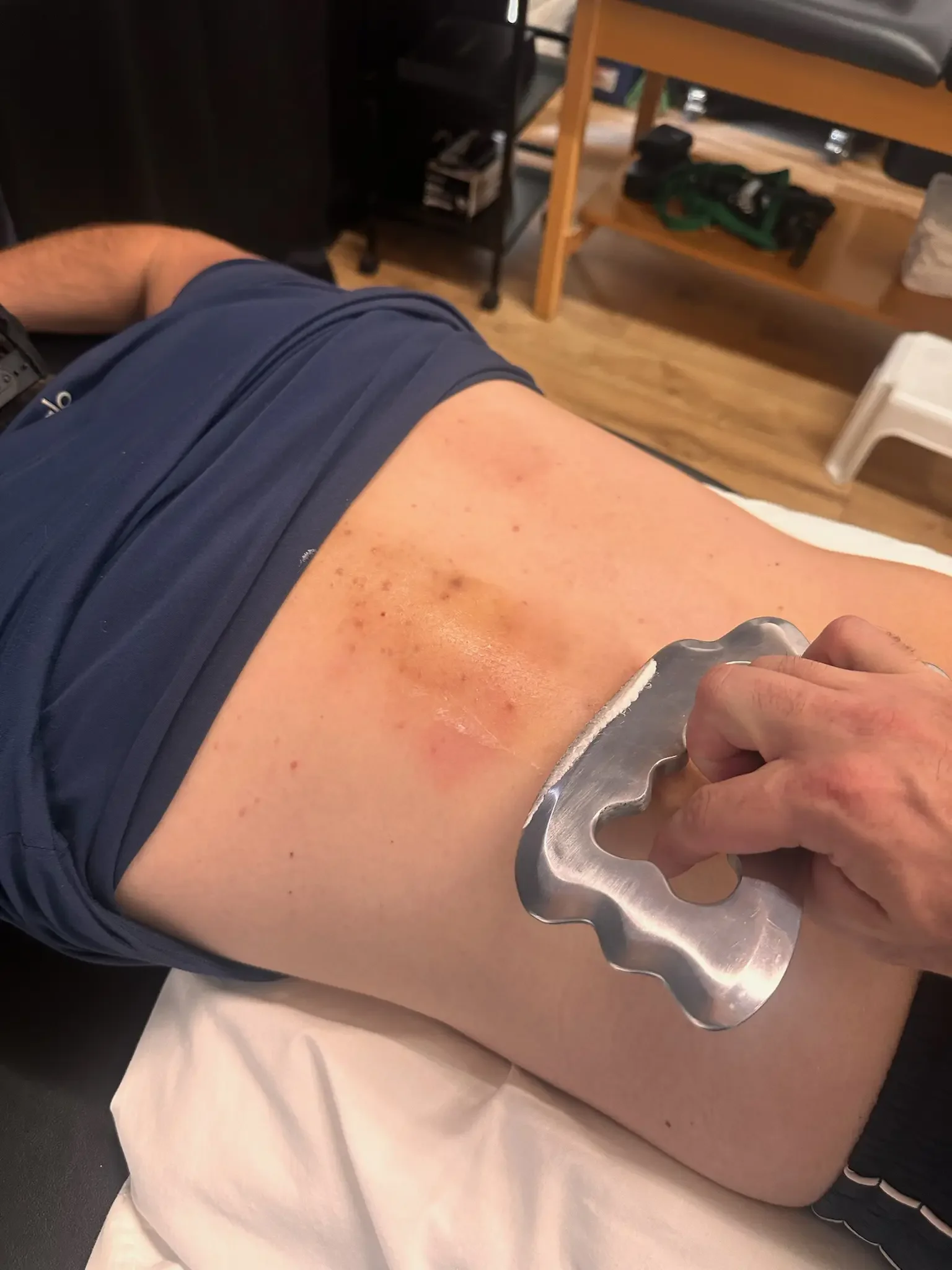 scraping recovery session for out of town travelers in Scottsdale and Arcadia.