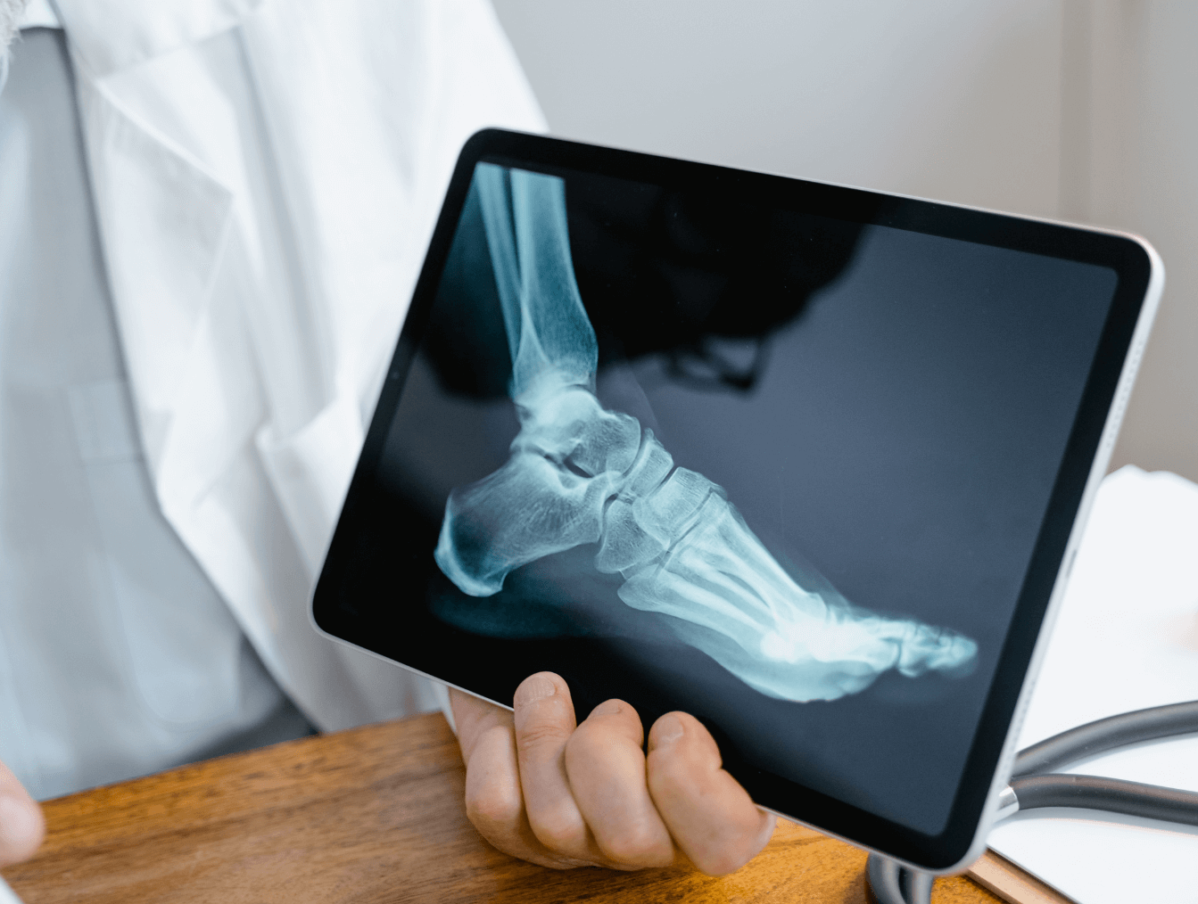 Medical professional holding a tablet displaying an X-ray image of a foot and ankle.