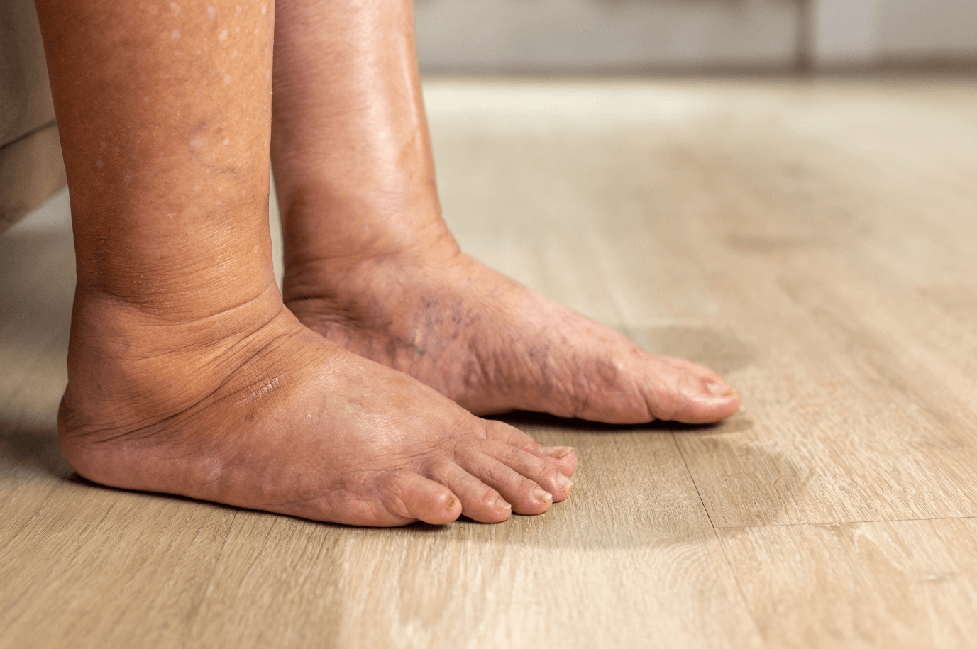 Close-up of elderly person's feet on hardwood floor, showing signs of aging and skin changes.