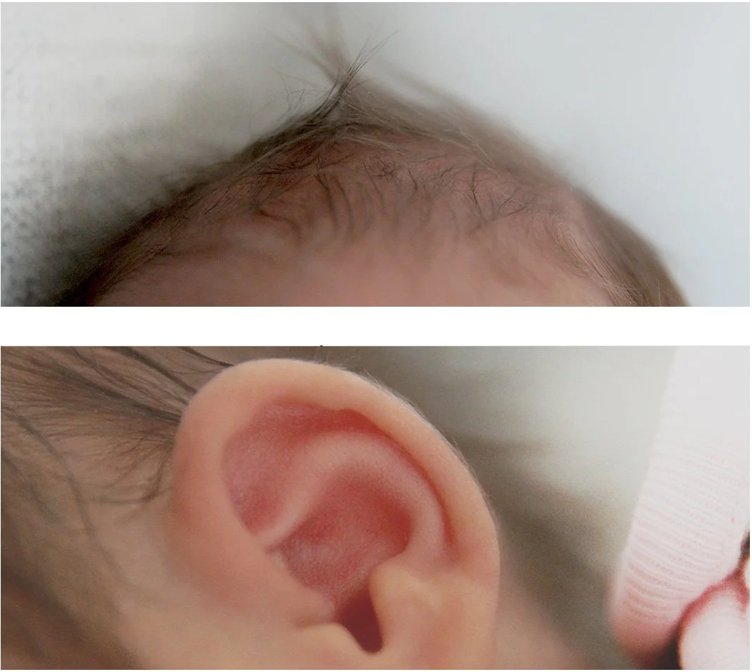 Nahaufnahme eines Babykopfes, oben Haare auf der Kopfhaut, unten ein Ohr.