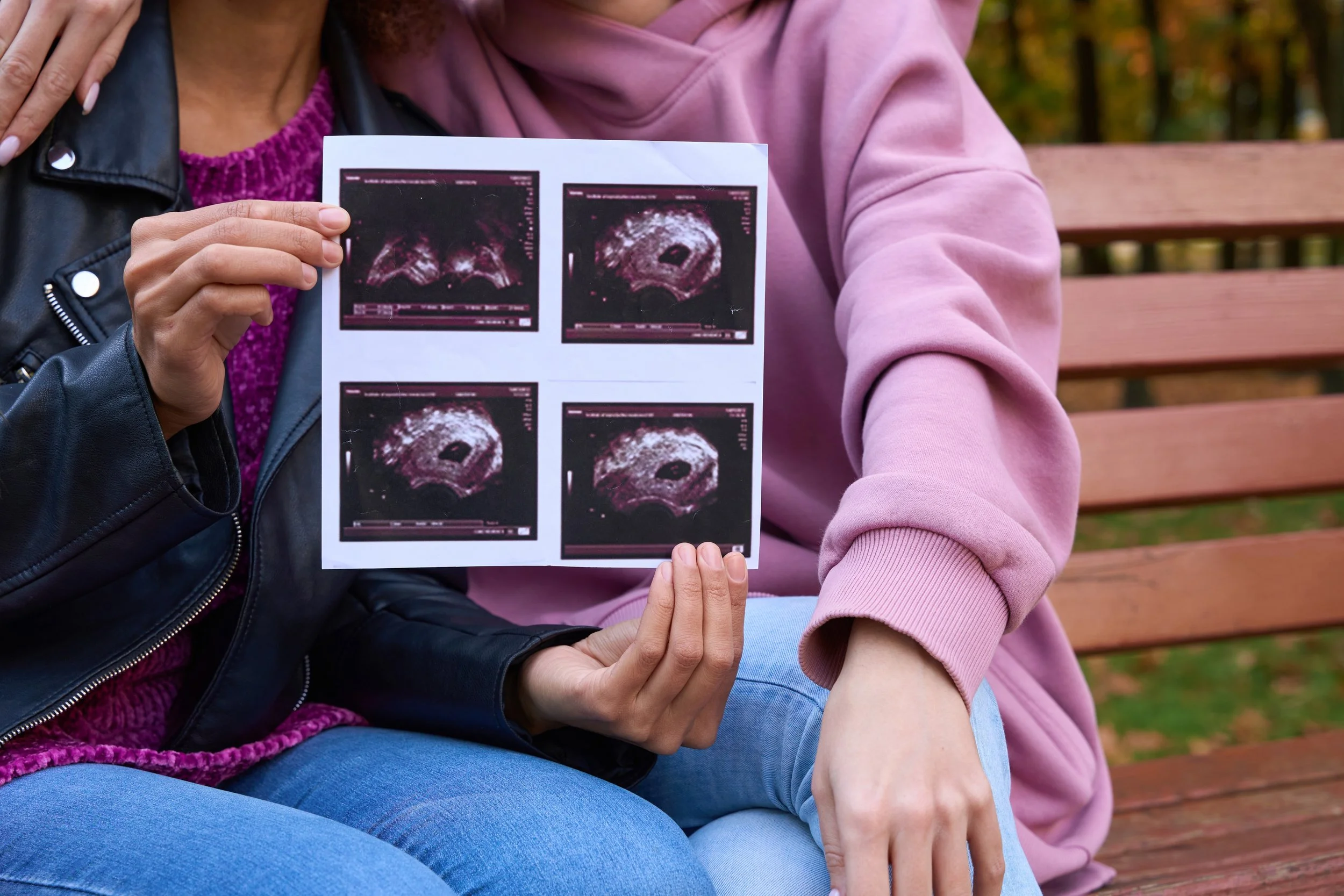 Now is the time to introduce new innovative assisted reproduction methods to implement accessible, affordable, and demonstrably successful advanced infertility services in resource-poor countries