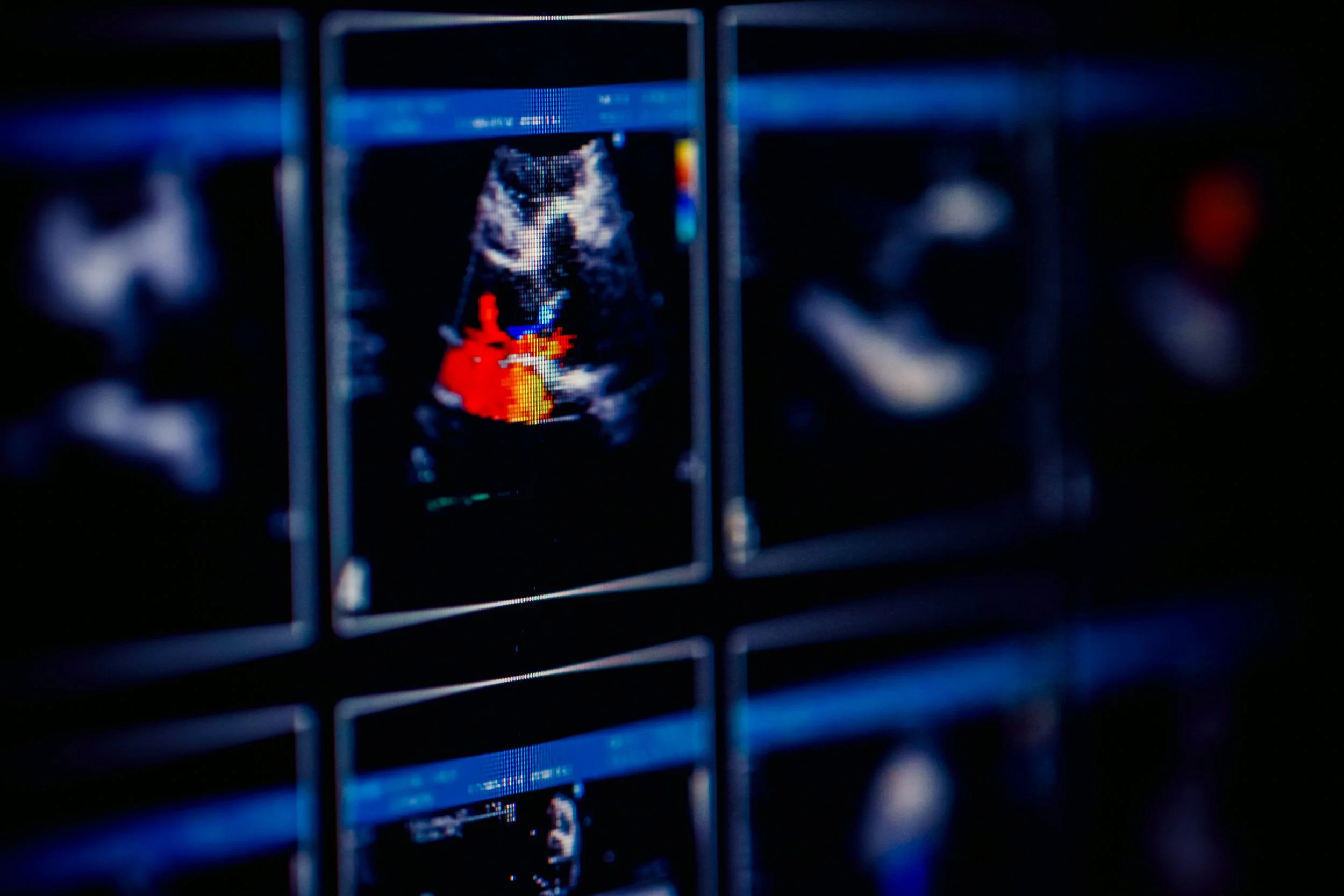Ultrasound derived indices of follicular blood flow before HCG administration and the prediction of oocyte recovery and preimplantation embryo quality