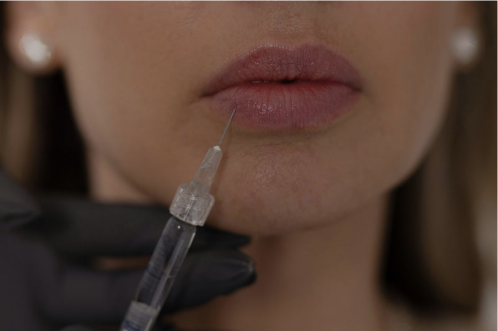 Different Lip Filler Shapes 