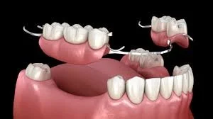 Removable and Fixed Dentures