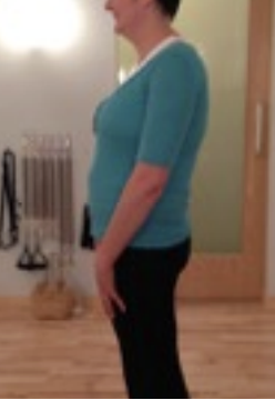 Loose PEC postural pattern with decreased spinal extension and reduced posterior chain engagement in Postural Restoration therapy