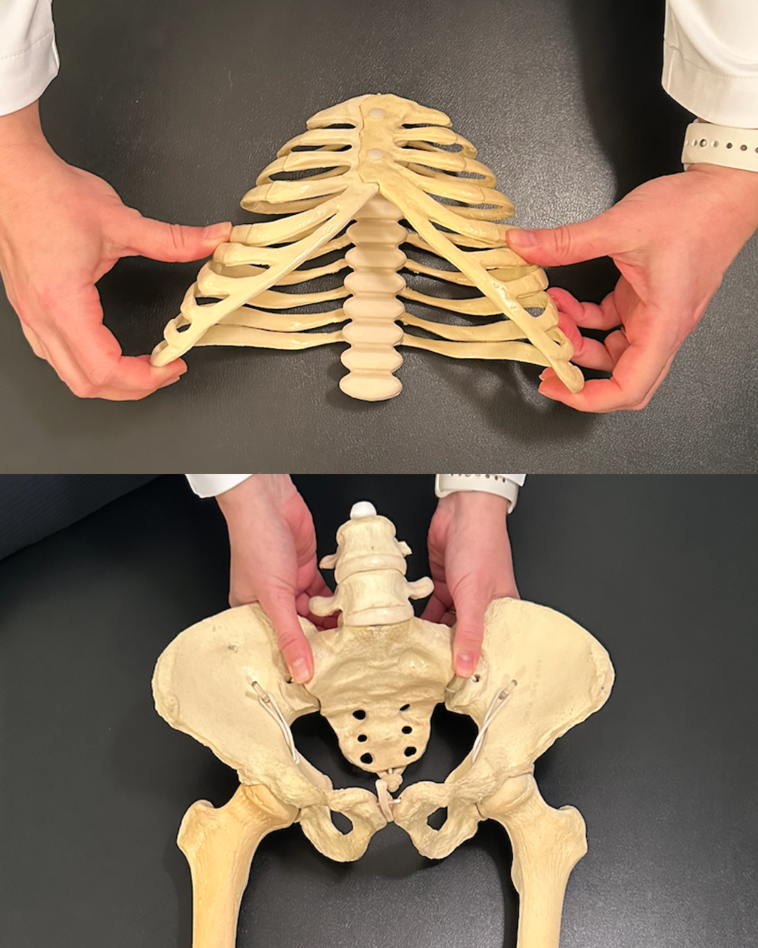 Skeleton demonstrating a PEC postural pattern with ribcage asymmetry and thoracic rotation. Flared rib cage and a tilted pelvis. the pelvis is tipped forward. May impact breathing a posture causing pain.