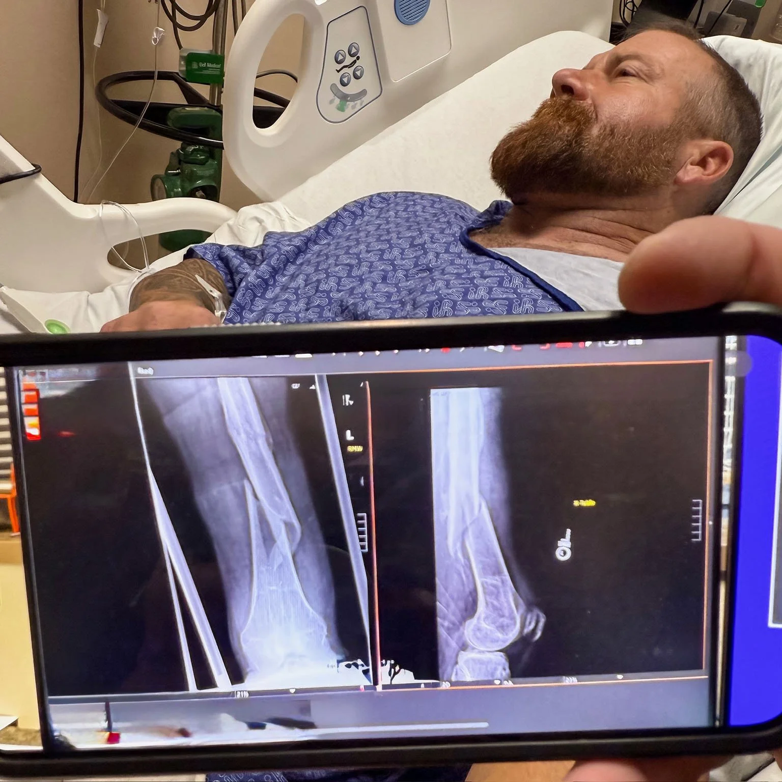 Dan's physical setbacks caused some delays in the custom project.jpg