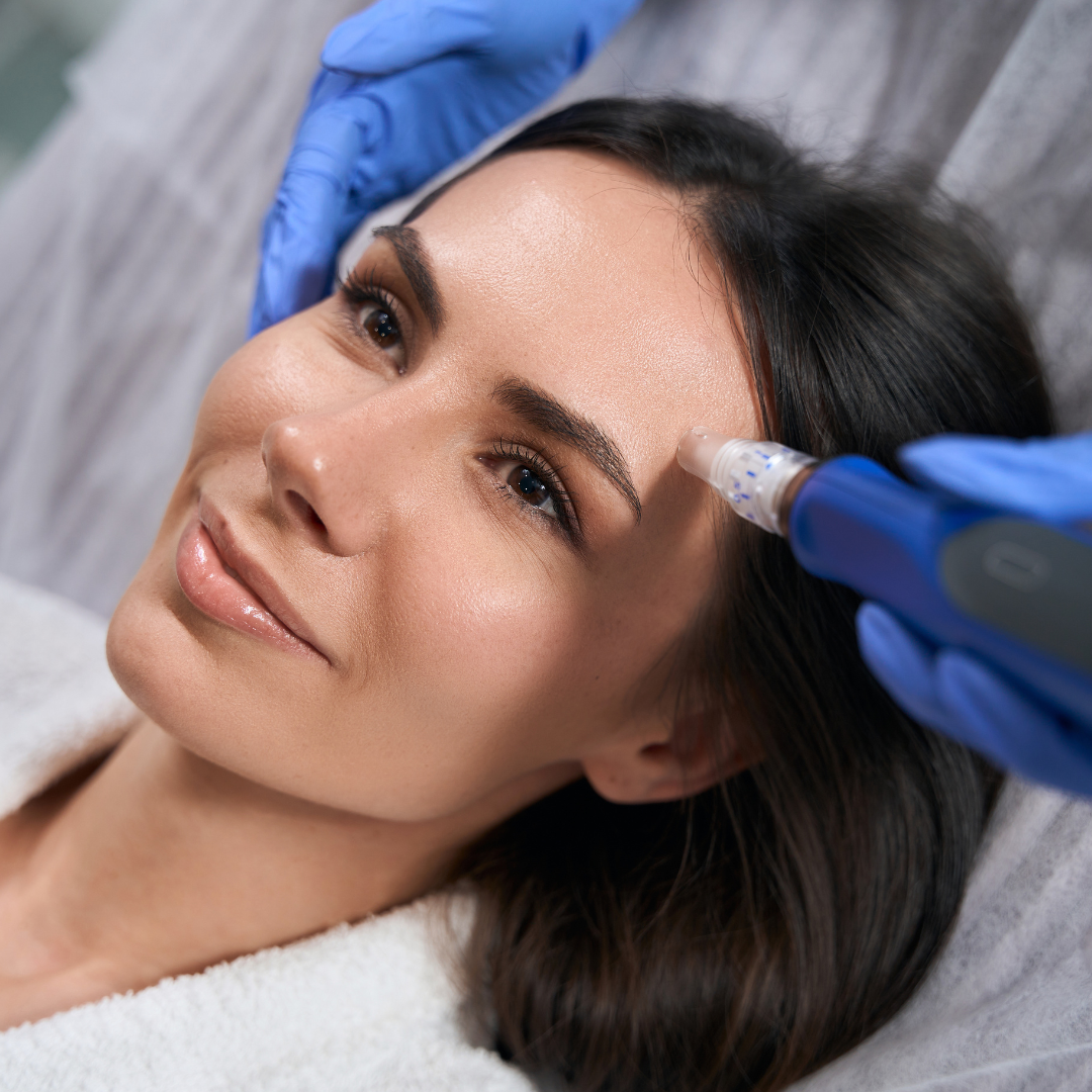 Medspa in Springfeild, OR 97477 l Microneedling Near Me