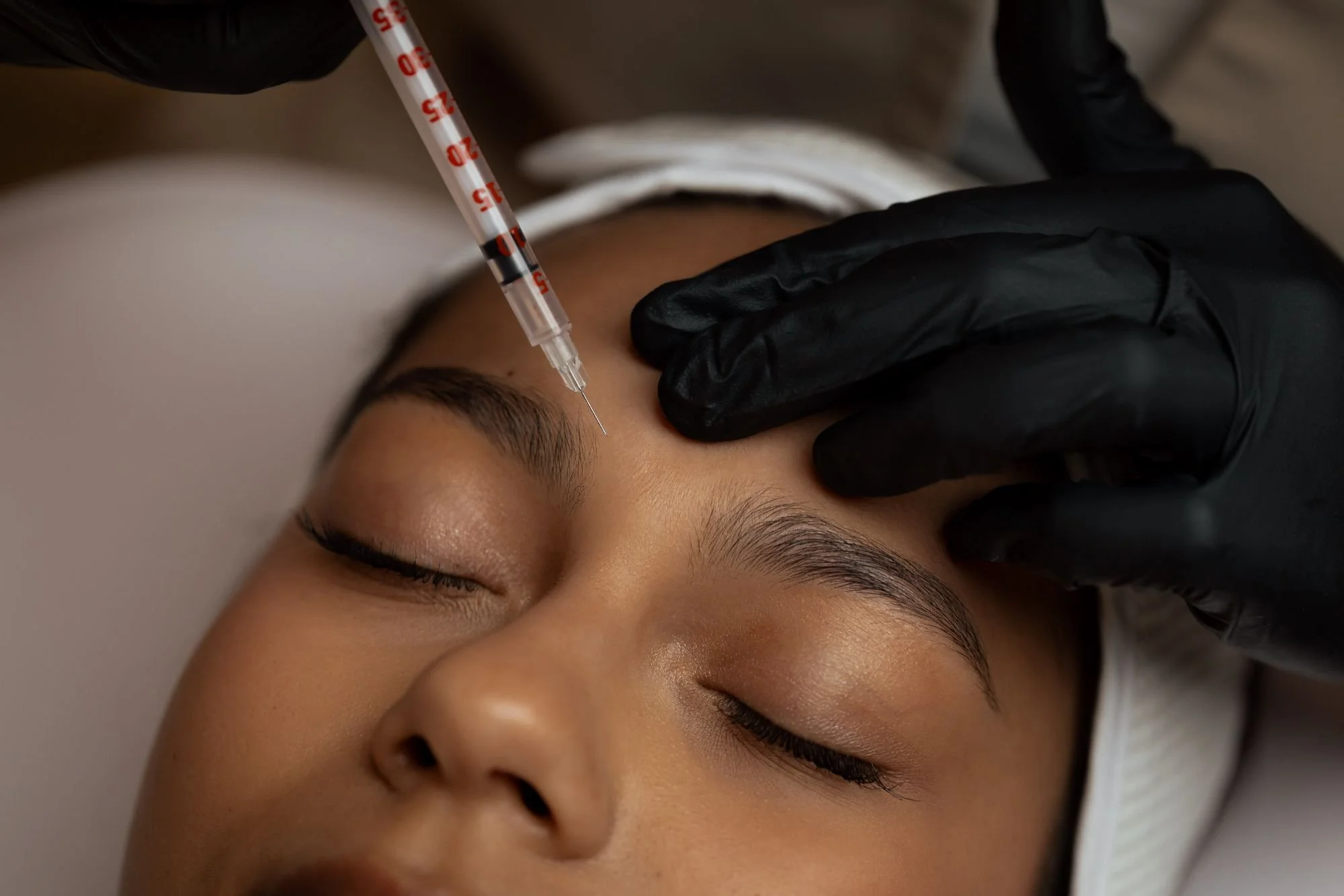 Close up of dermal filler being injected into a woman's brow area.