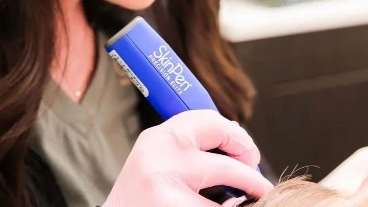microneedling-with-skinpen-in-oviedo.jpg