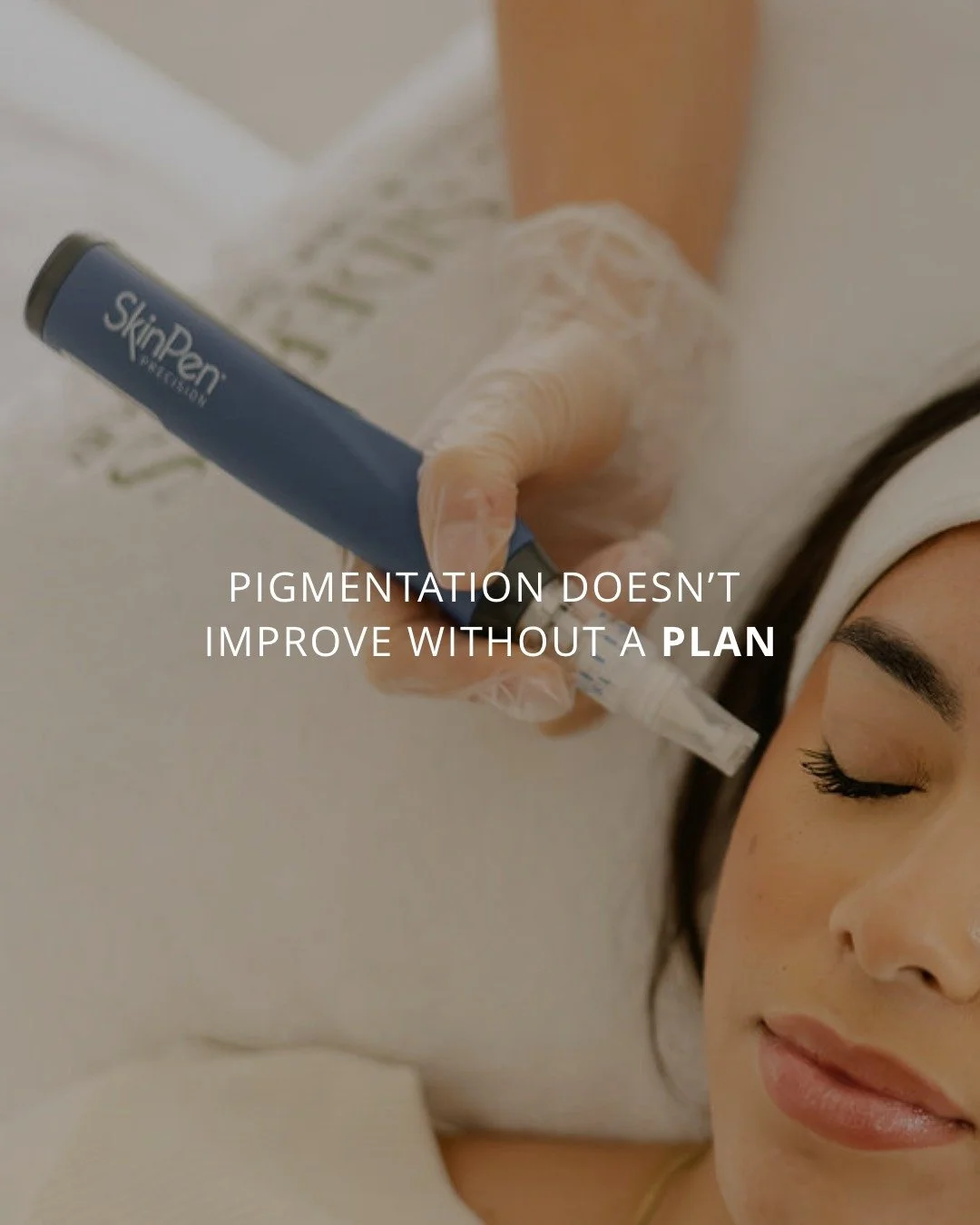 Pigmentation doesn&rsquo;t improve without a plan 👀 Melasma and pigmentation require more than one-off treatments or trend-led fixes. They respond best to a structured, skin-first approach and that&rsquo;s where chemical peels come in.

When prescri