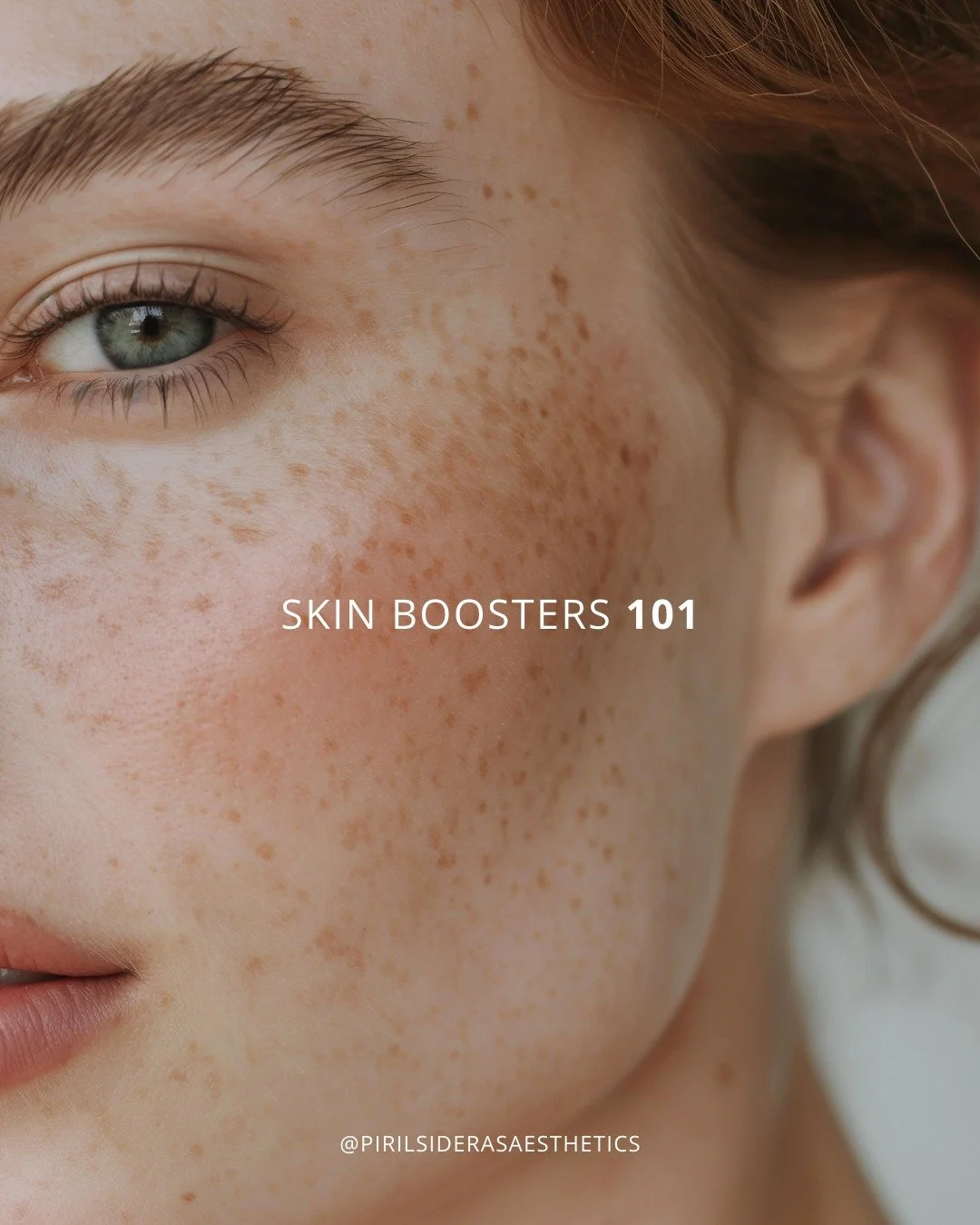 This is exactly why we talk so much about skin quality in clinic 💬✨

Soo many patients think they need &ldquo;filler&rdquo; when actually&hellip; they just need better skin.

Skin boosters are one of our favourite starting points because they:
&bull