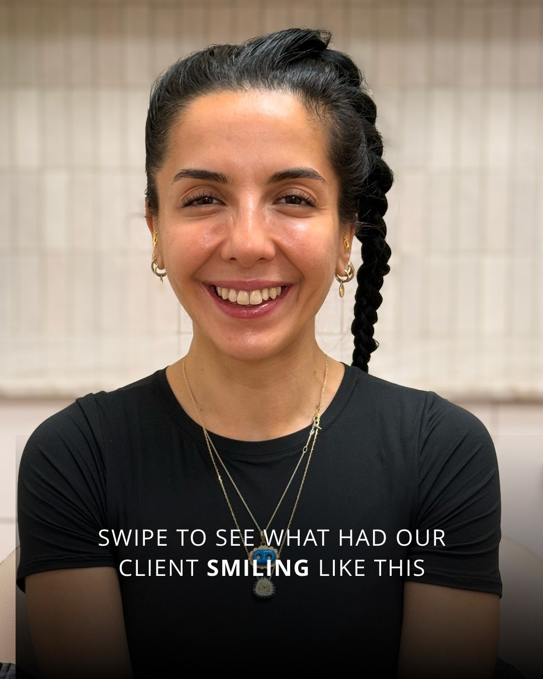 Facial harmonisation is about balance, not changing your face 
We look at your features as a whole and create a personalised plan to subtly enhance, support and refine. That might mean lips, skin boosters, profile balancing or under-eye treatments, a