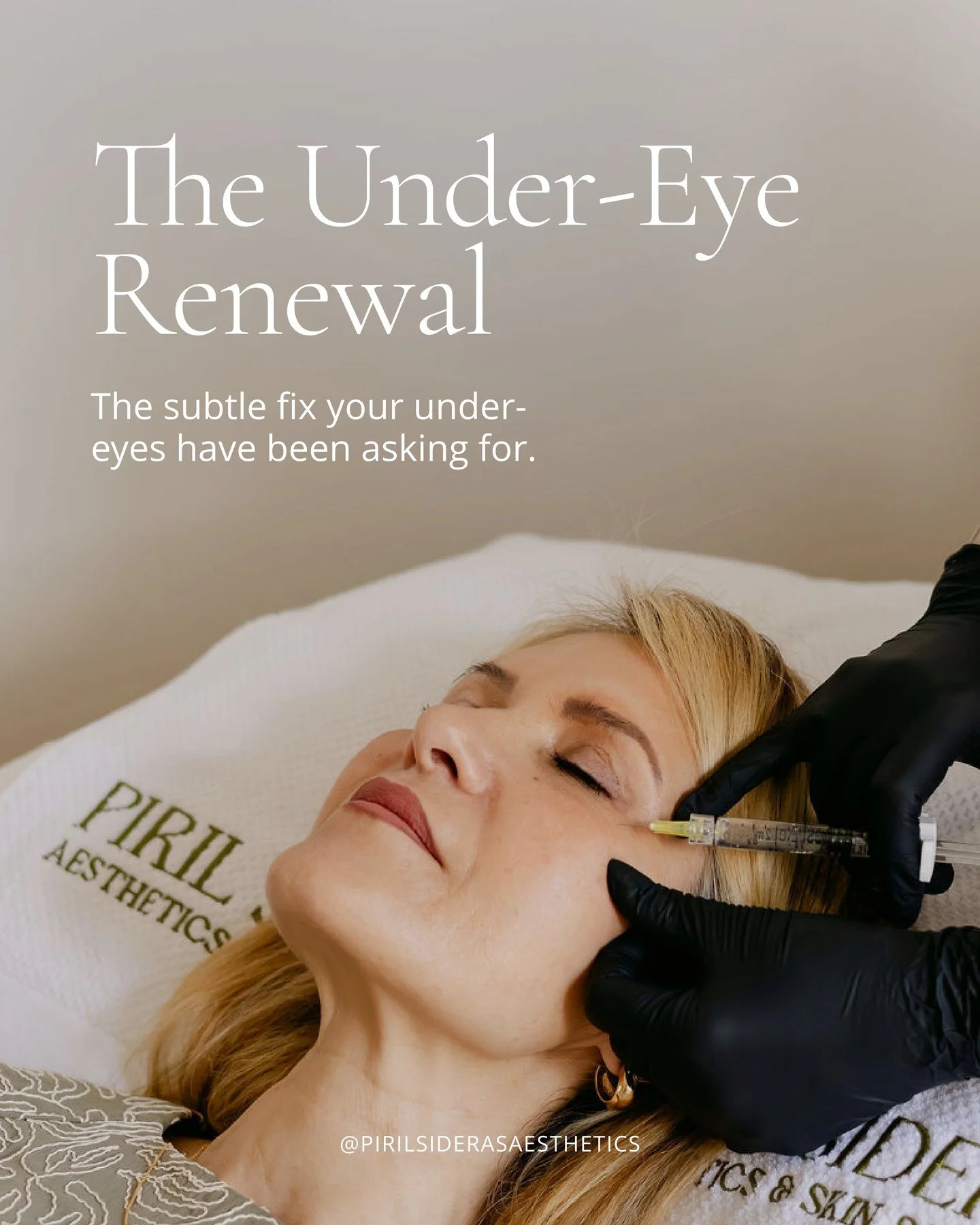 The under-eyes are often the first place to show that something has shifted&hellip; even when the rest of your face still feels like you.

It might be a little more hollowing, a softer kind of darkness, or skin that doesn&rsquo;t reflect light the wa