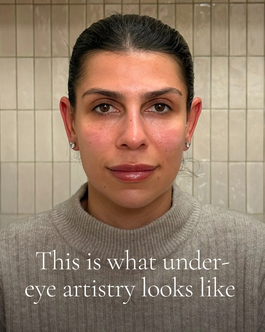 Most people think under-eyes are just about looking tired.

But often, it&rsquo;s a combination of dehydration, thinning skin, shadowing, volume loss, and collagen depletion happening gradually over time. Which is why concealer stops sitting properly