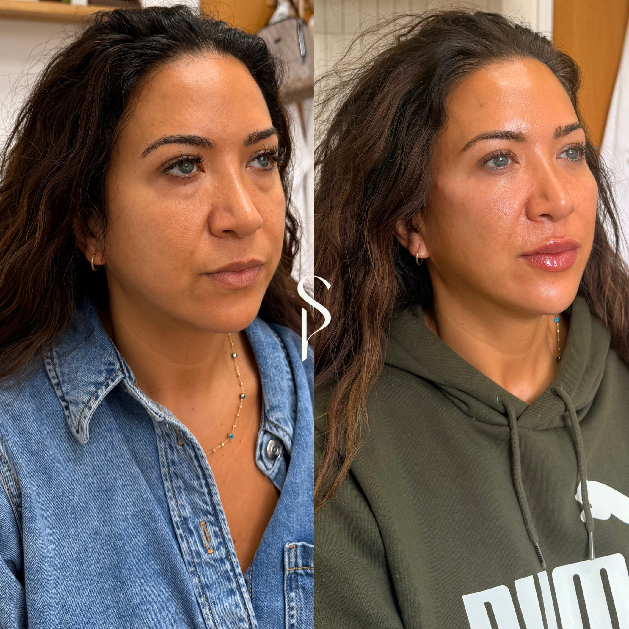 Comparison of a woman before and after skincare, showing improved skin texture and glow.