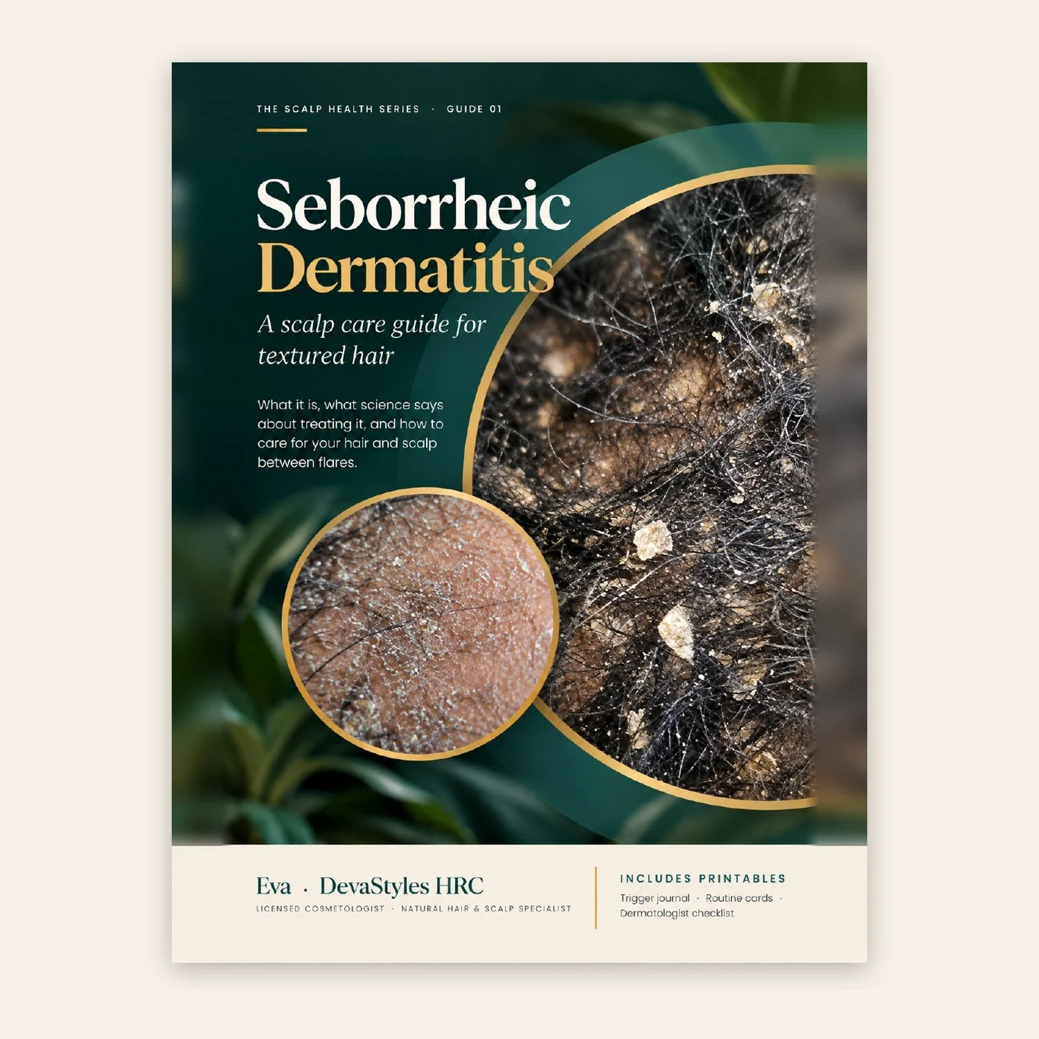 SEBORRHEIC DERMATITIS: A SCALP CARE GUIDE FOR TEXTURED HAIR