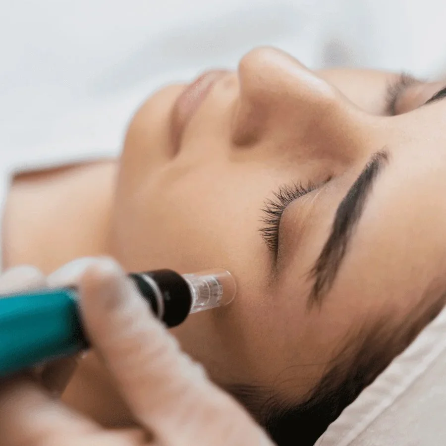 Skin Renewal Ritual – Microneedling