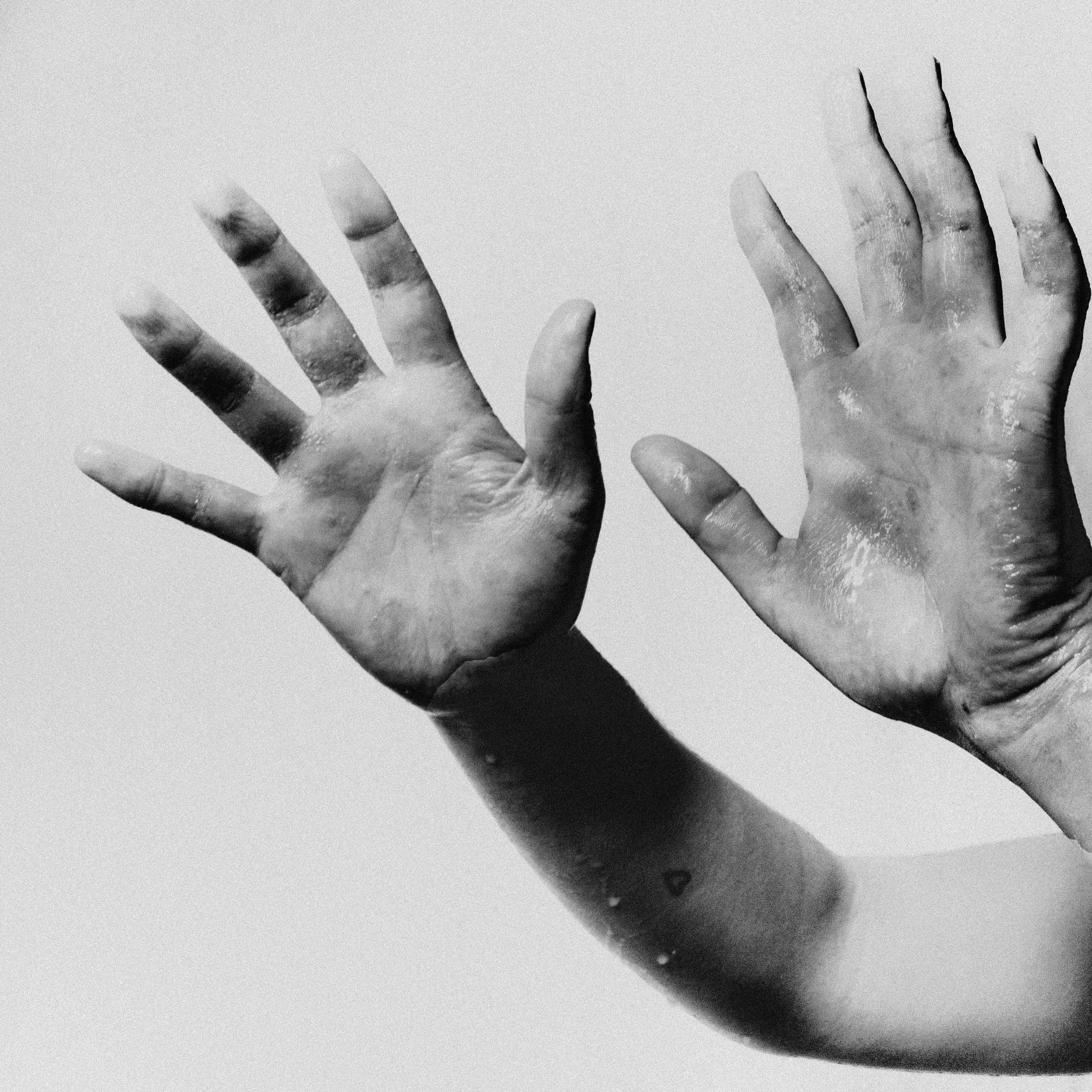 Deux mains levées avec paumes ouvertes, en noir et blanc.