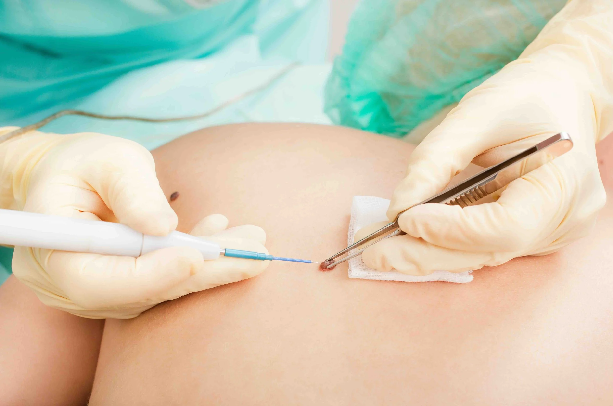 Ärzte führen eine medizinische Injektion bei einem Patienten durch.