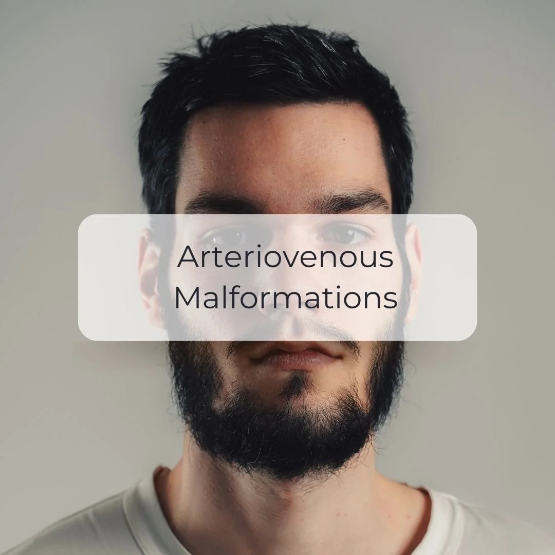 Arteriovenous Malformations.jpg