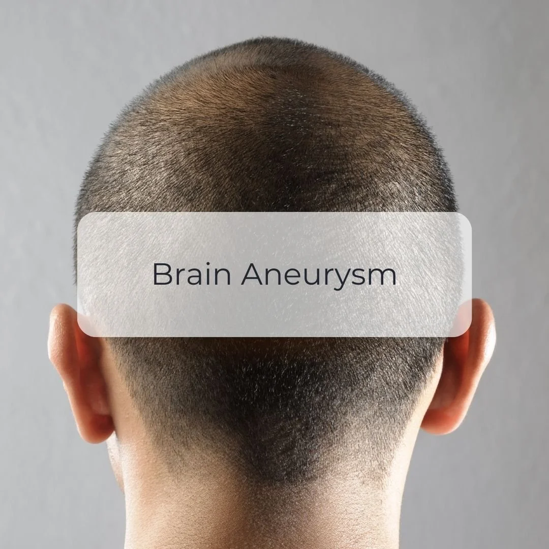 Brain Aneurysm.jpg