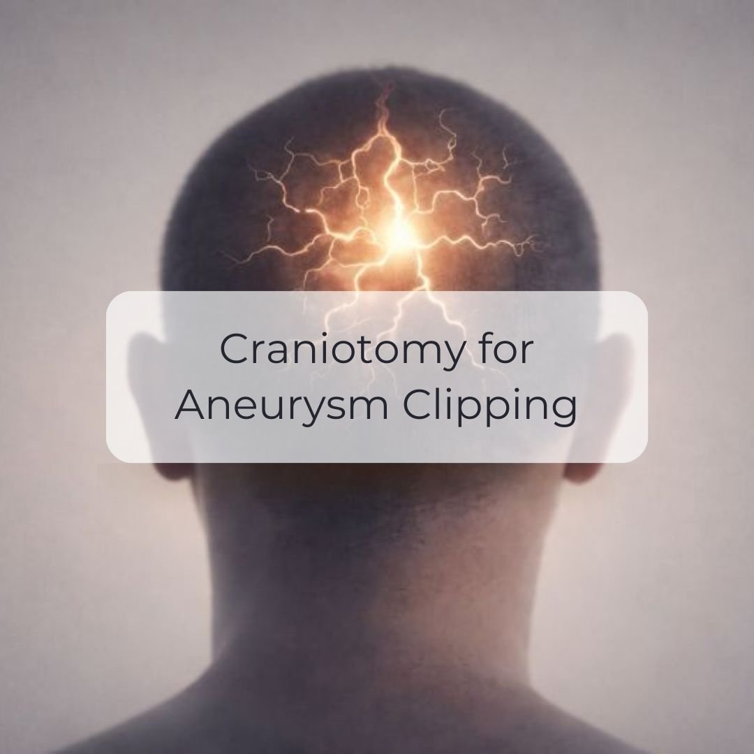 Craniotomy for aneurysm clipping.jpg