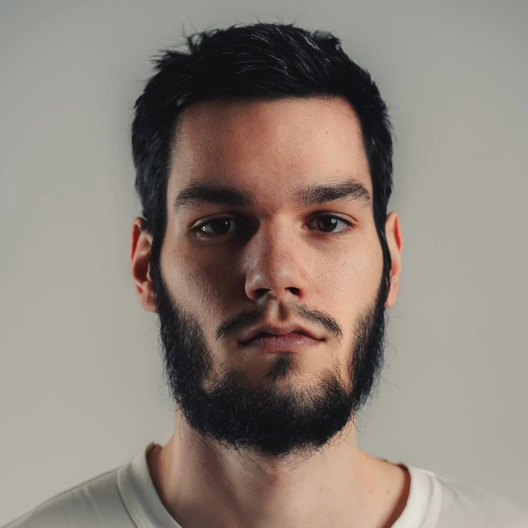 Man with Arteriovenous Malformations.