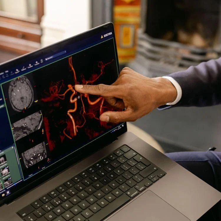 Neurosurgeon in London looking at brain aneurysm scan