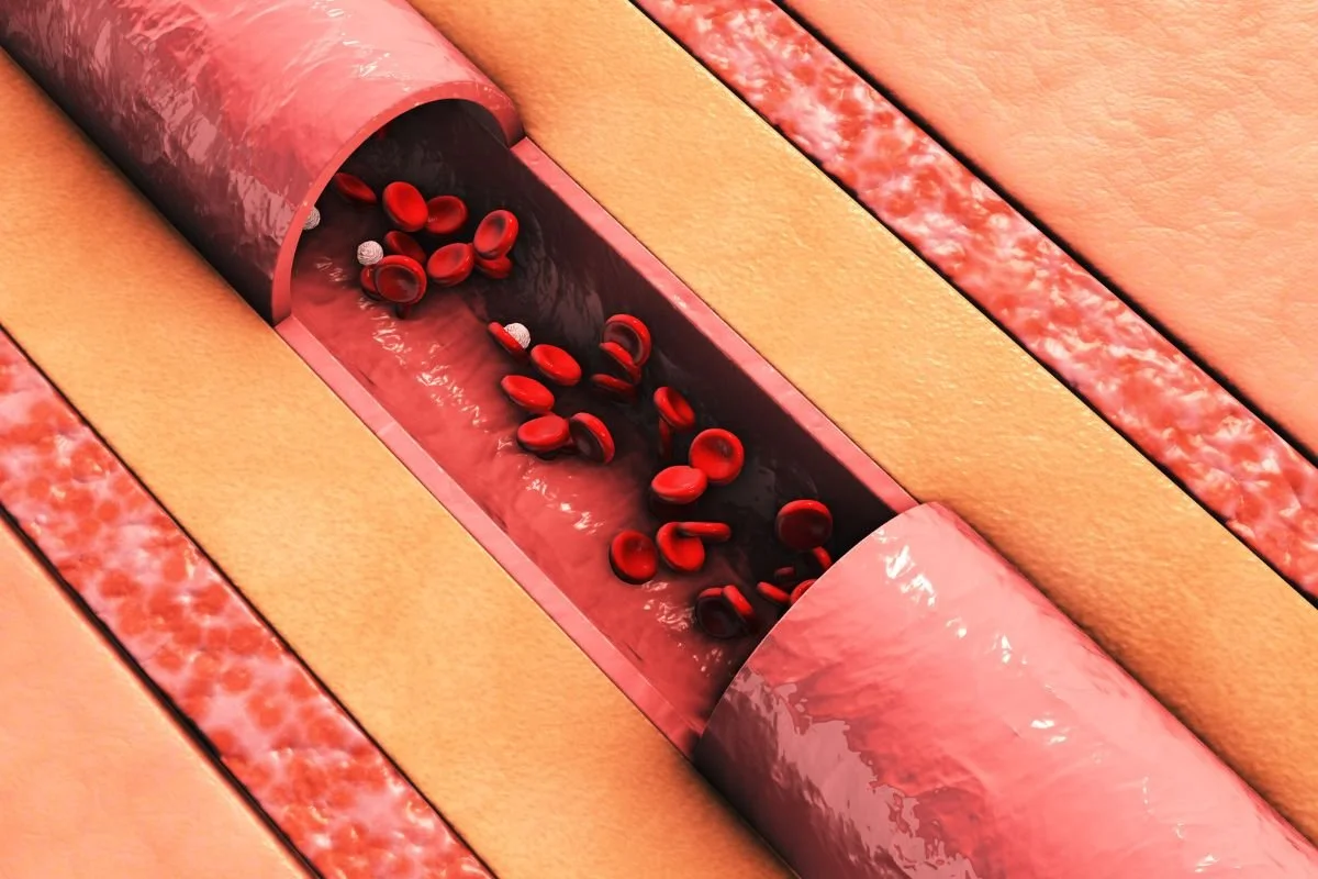 Graphic image depicting blood flow