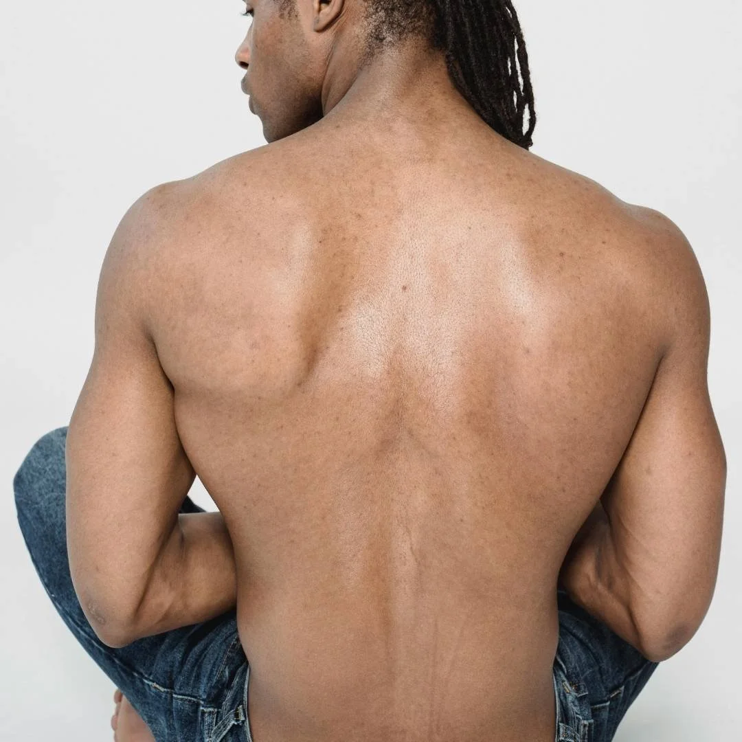 Man suffering from Degenerative Disc Disease