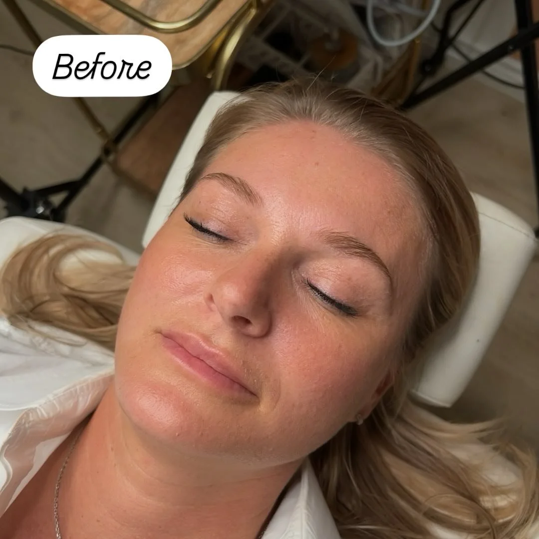 Me: Don&rsquo;t forget to take a before photo. Also me: halfway through the brows. Luckily I caught this one just in time! Brows and facials. My favorite combo 🙂

#walnutcreek #bayareaesthetician #facials