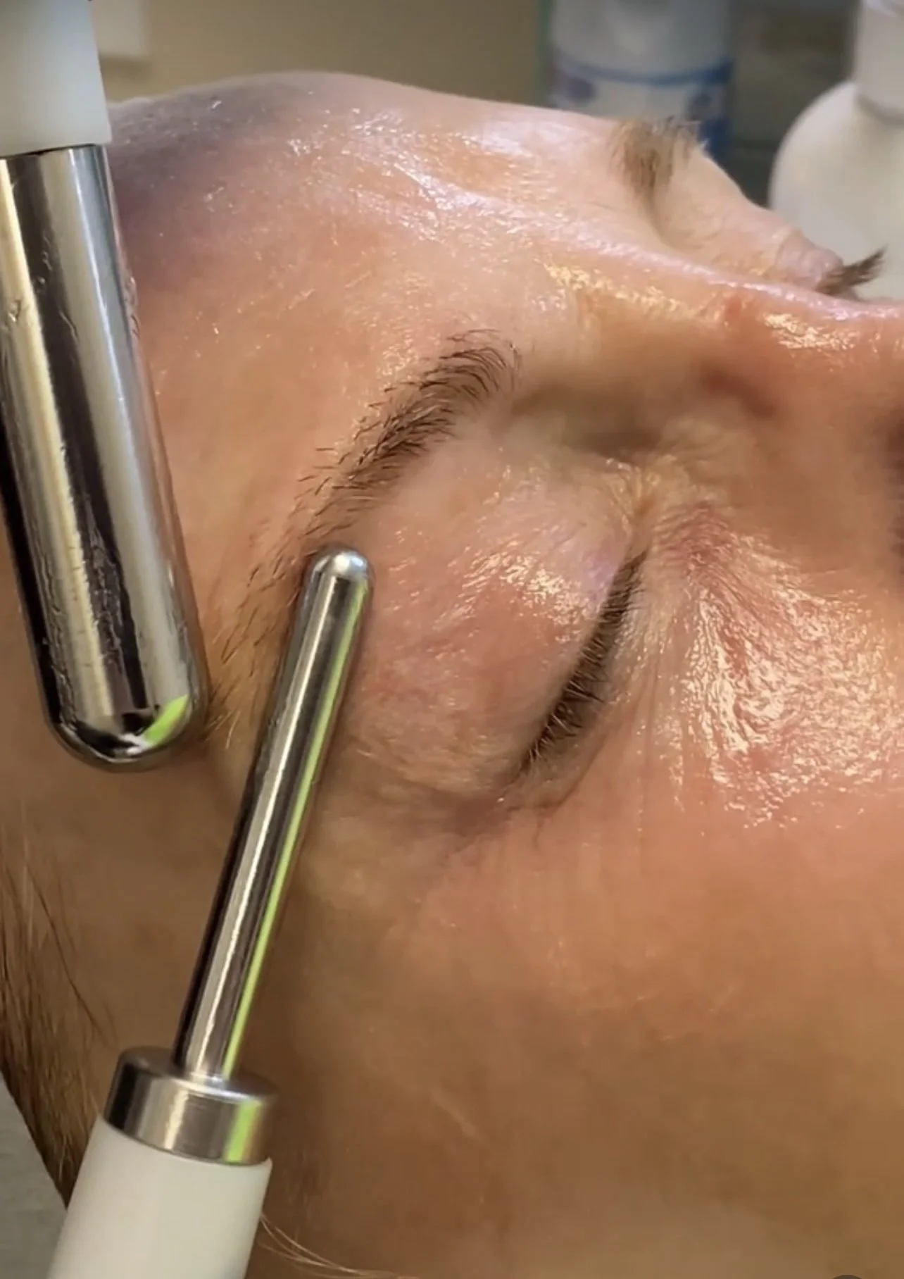 TriaWave microcurrent facial in Buckeye AZ for skin lifting and firming
