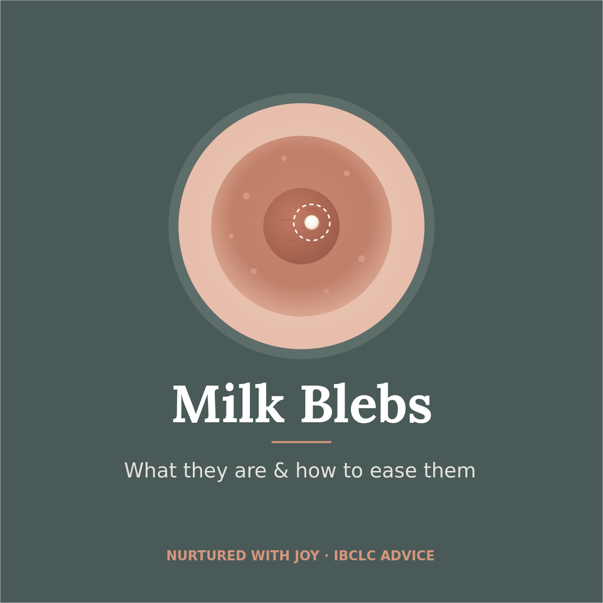 Milk Blebs While Breastfeeding: What they are, why they happen and how to ease them