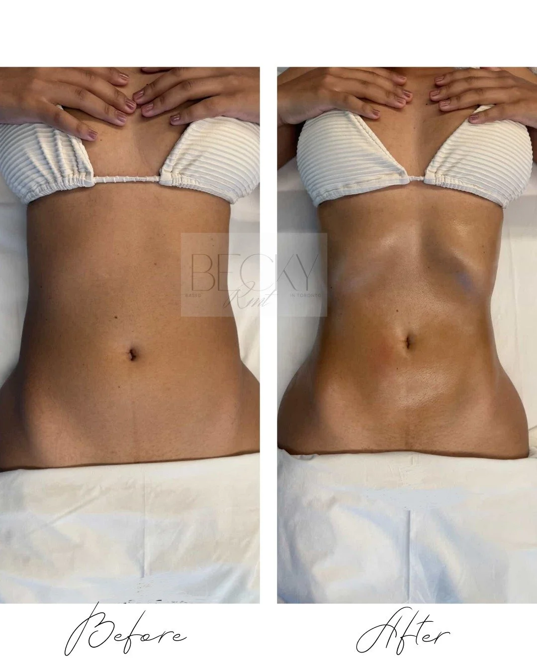 Photos shown with client consent. Results may vary.

📍 North York, Toronto