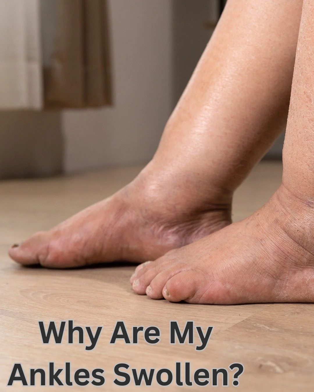 Swelling in the lower legs can happen for several reasons, including:
&bull; lymphedema
&bull; fluid retention
&bull; prolonged sitting or standing
&bull; injury or inflammation
&bull; lymphatic congestion

Understanding the cause is the first step t