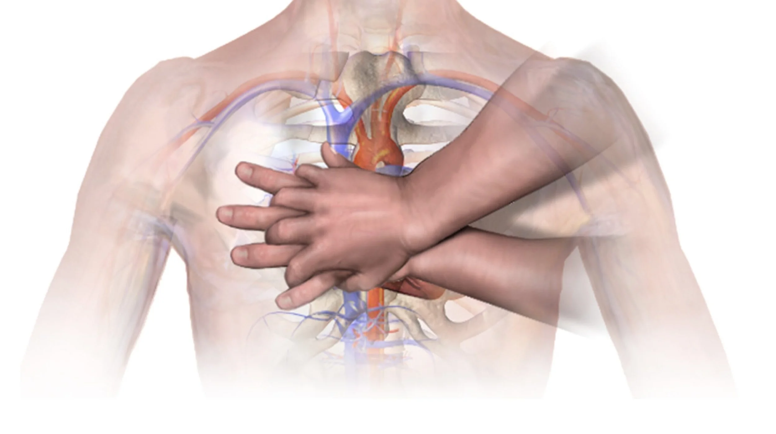 Someone Trained in CPR Saved My Life