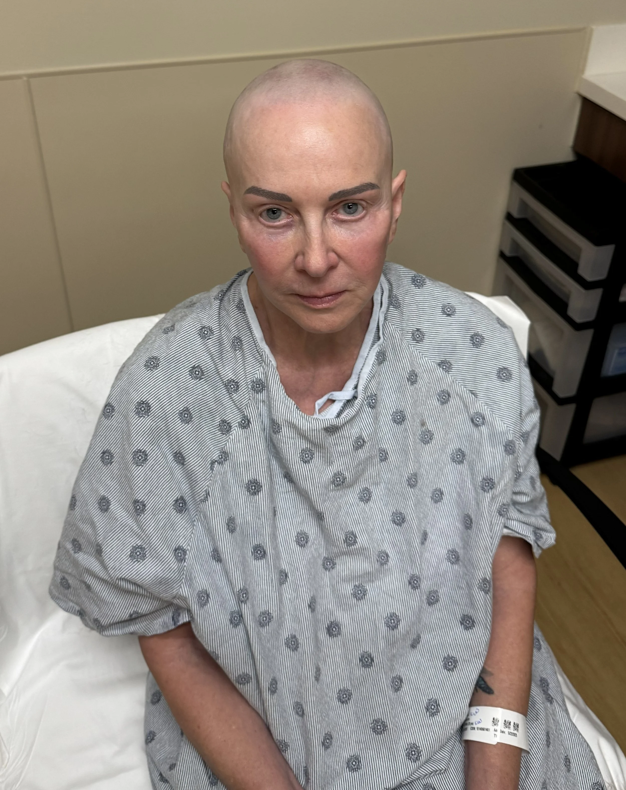 Brain Surgery-Are You Nuts?