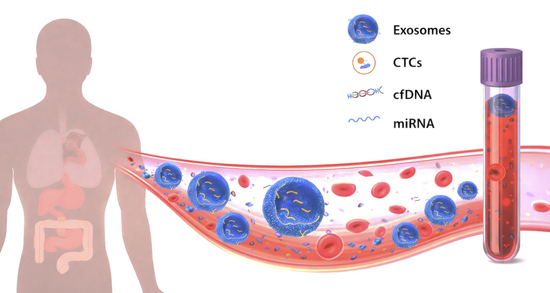 Illustration of exosomes, CTCs, cfDNA, and miRNA in the bloodstream, with a test tube containing dark blue exosomes and red blood cells.